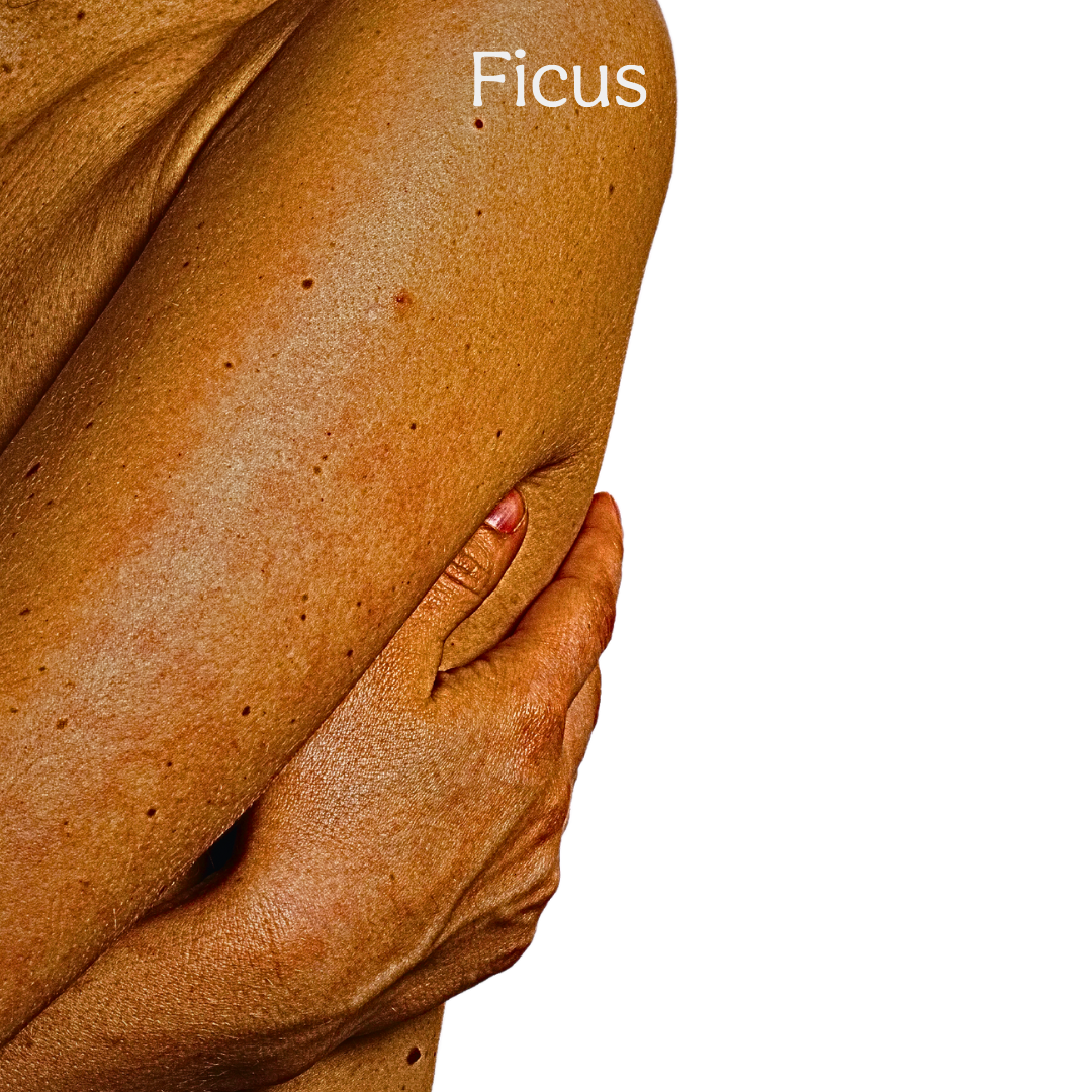 FICUS